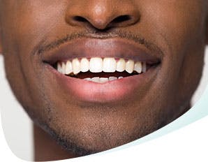 Lower half of face with smile that shows teeth