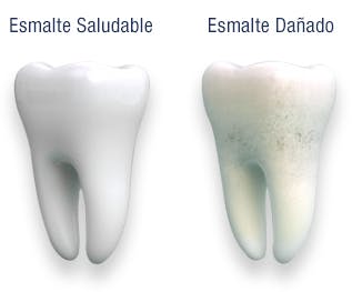 Comparison of Healthy Enamel and Damaged Enamel