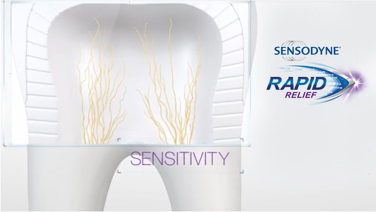 Sensodyne Beat Sensitivity Fast Sensodyne Rapid Relief Ad - Advert