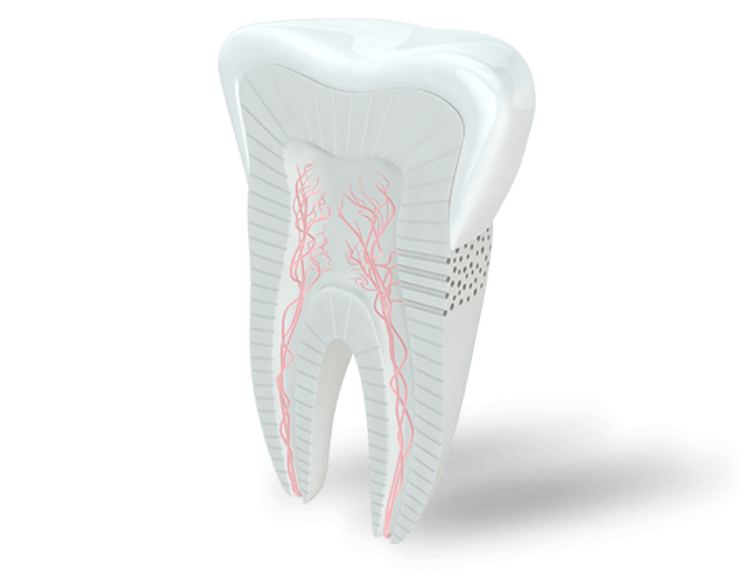 Cavity Between Teeth - Causes and Treatment Options