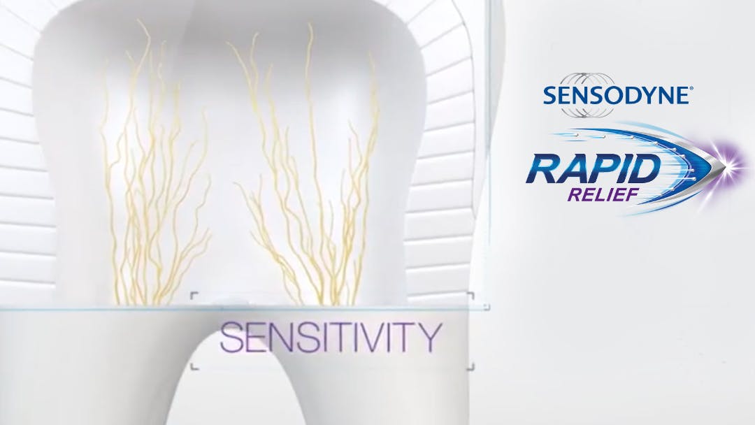 Video showing how Sensodyne Rapid Relief targets tooth sensitivity