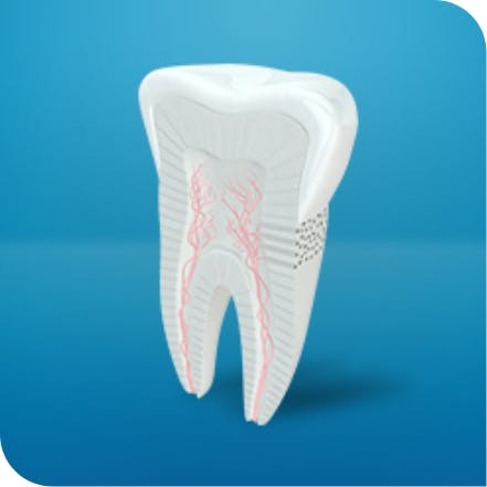 sensodyne after filling