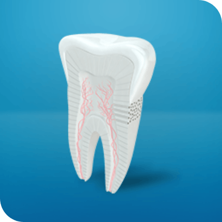 is it cavity or sensitive teeth