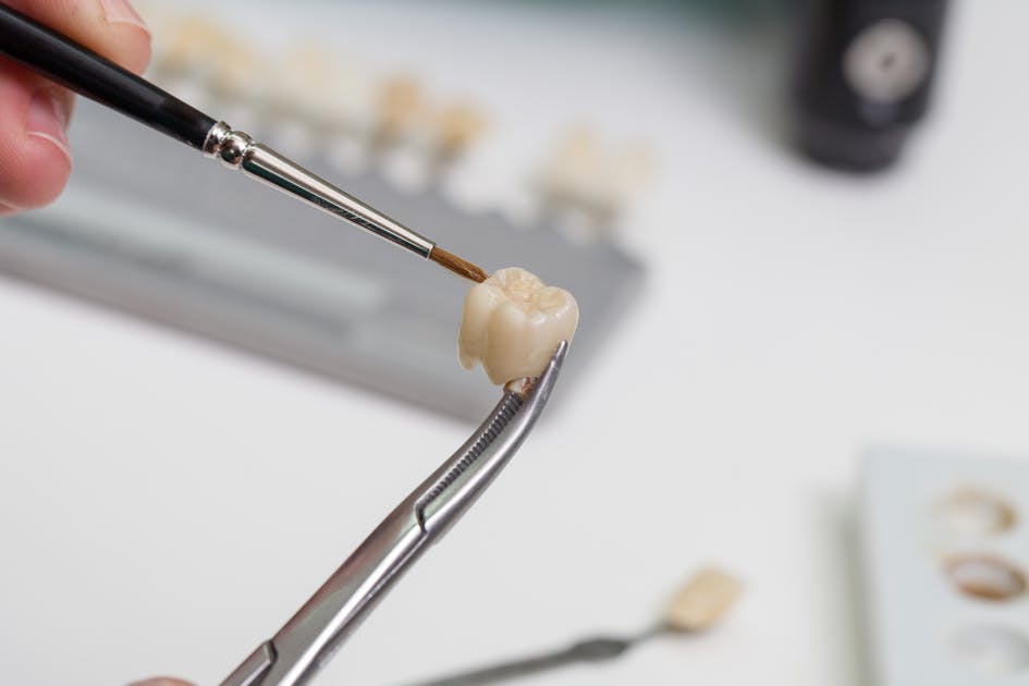 Painting a tooth crown