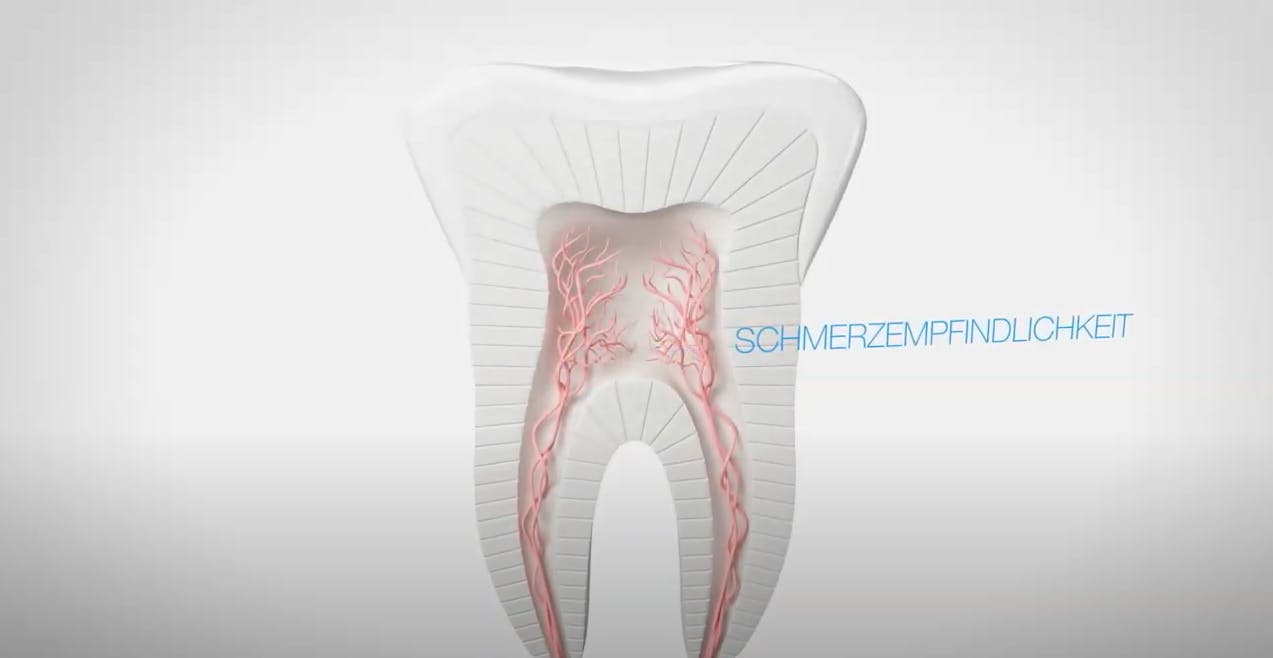 Video that explains how tooth sensitivity develops in your mouth