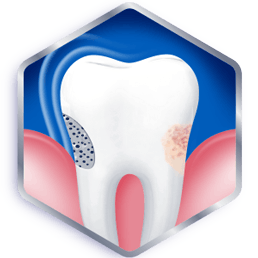 protection of teeth and gums