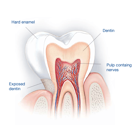 enamel protection