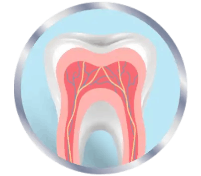 Inflammed nerves in teeth