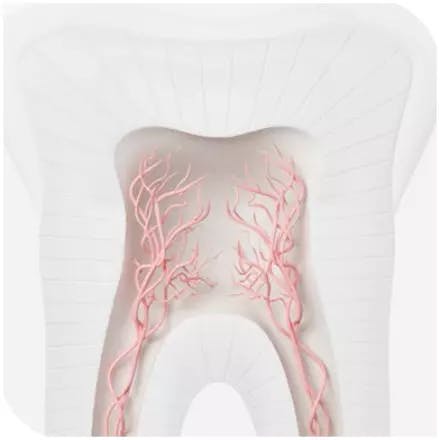 Triggered nerves in teeth