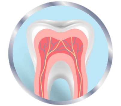 Nervios inflamados en los dientes