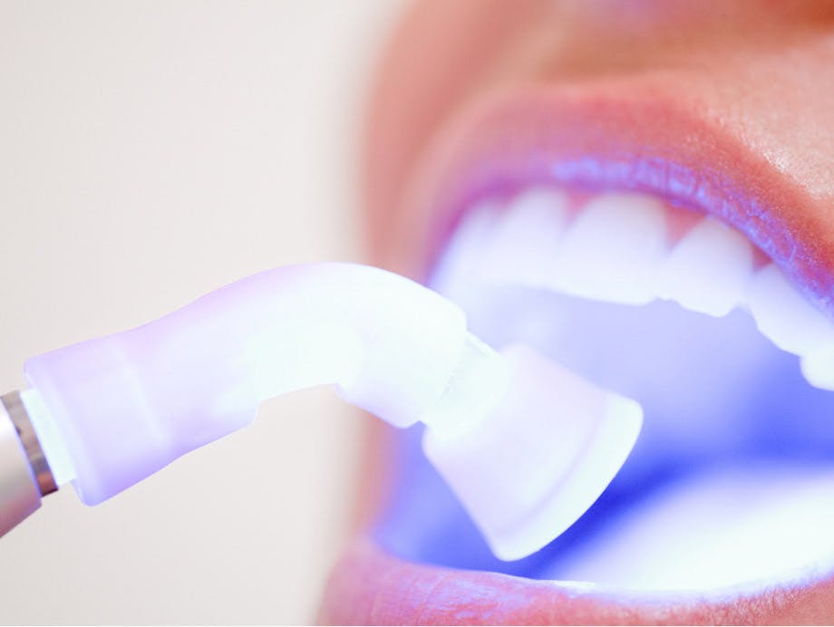Sensitive teeth whitening