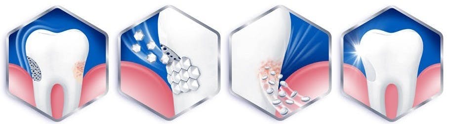 Alivio de la sensibilidad dental y problemas de encías Alivio de la sensibilidad dental y problemas de encías