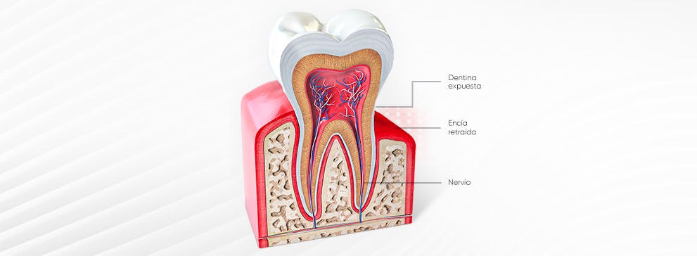 ¿Qué es la sensibilidad dental?​