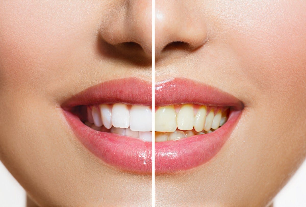 Mujer sonriendo con los dientes brillantes