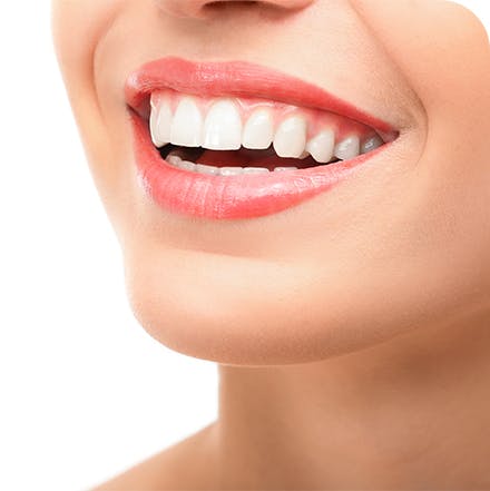 Nainen hymyilemässä valkoisilla hampailla