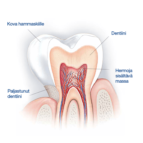 Hammaskiille: Kerros, joka suojaa hampaitamme