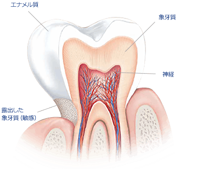 エナメル質：歯を保護している層