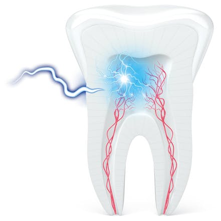 Hot coffee can be the cause of your tooth sensitivity symptoms