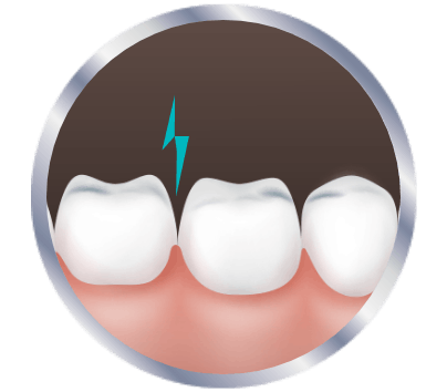 Ikon av smerter i tennene, illustrert med et lite støt som kommer opp mellom to tenner