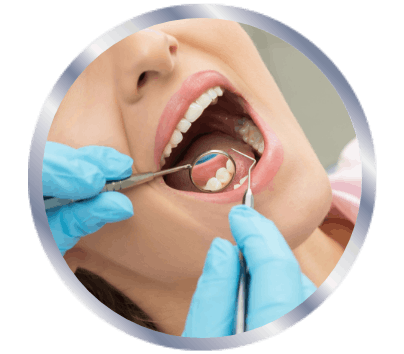 En kvinne om åpner munnen og blir undersøkt av en tannlege