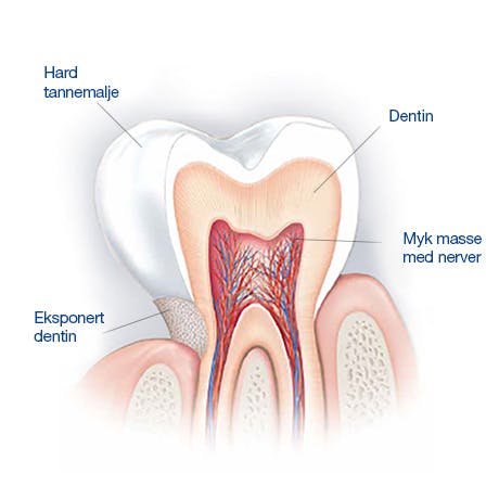 Illustrasjon av emaljen på tennene, med forklaring på de forskjellige tannlagene