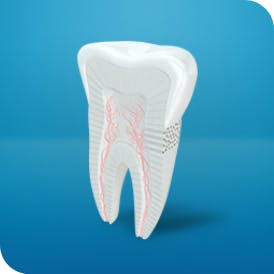 Tooth highlighting difference between cavity and sensitivity