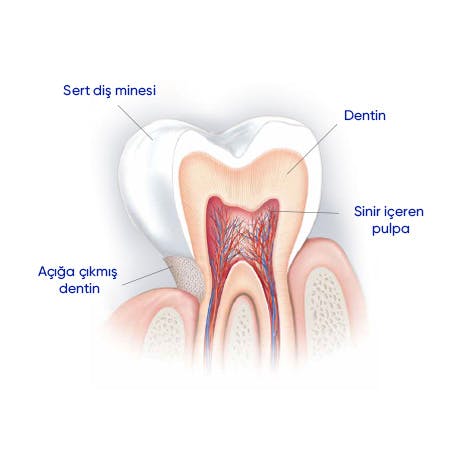 Tooth Enamel:  The layer of protection for our teeth