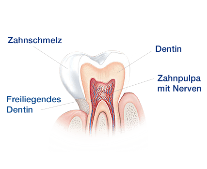 Was verursacht schmerzempfindliche Zähne?