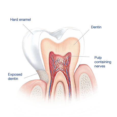 sensodyne causing pain