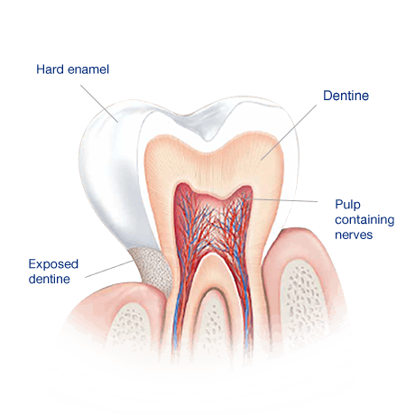 What Causes Sensitive Teeth? What Causes Sensitive Teeth?