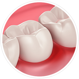 Gum Health and Sensitivity Gum Health and Sensitivity