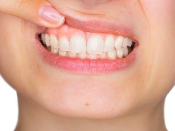 Woman pointing to gum and teeth Woman pointing to gum and teeth