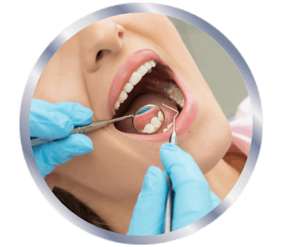 Woman opening her mouth for the dentist