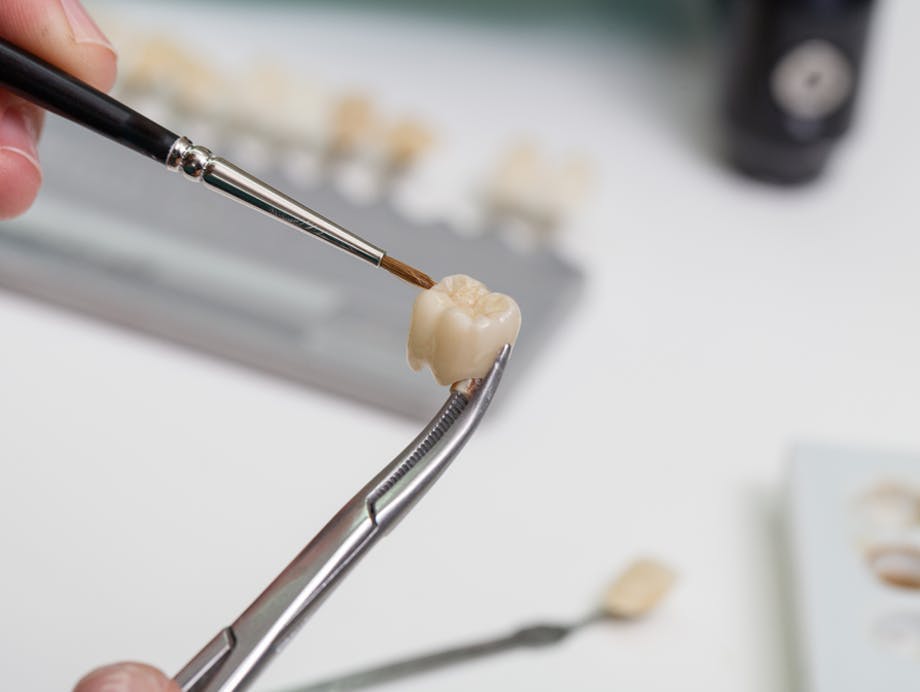 Tooth Pain After a Crown