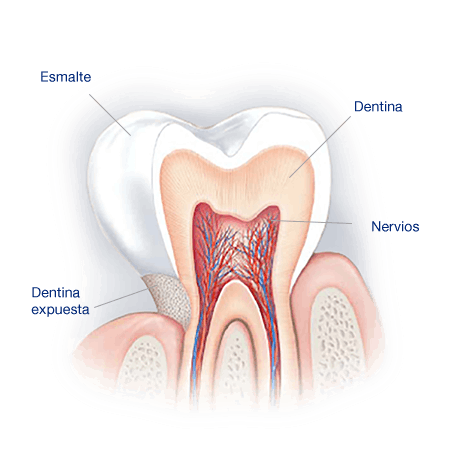 What Causes Sensitive Teeth? Causas de la sensibilidad dental - GSK