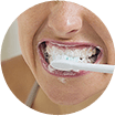 Tratando la sensibilidad dental