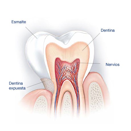 What Causes Sensitive Teeth?