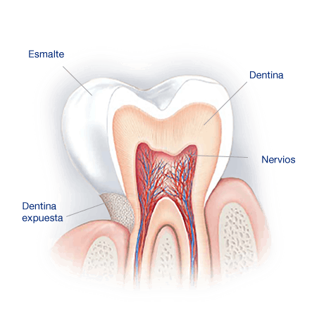 What Causes Sensitive Teeth?