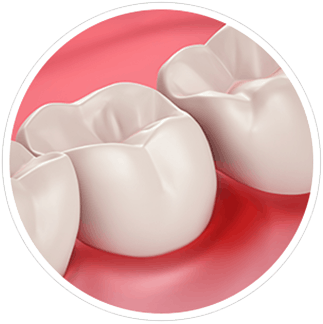 Salud de las Encías y Sensibilidad Dental Salud de las Encías y Sensibilidad Dental