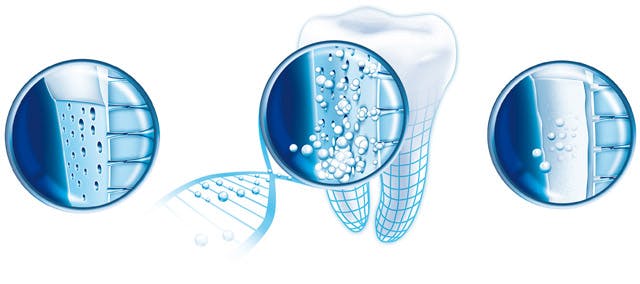 Reparación de los dientes sensibles