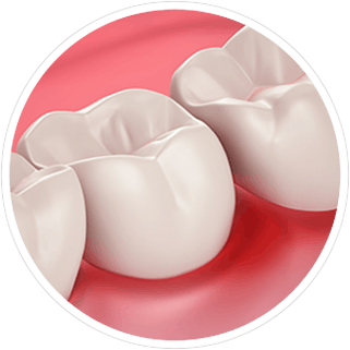 Salud de las encías y sensibilidad dental Encías sanas