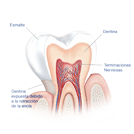 ¿Qué causa la sensibilidad dental? Partes del diente