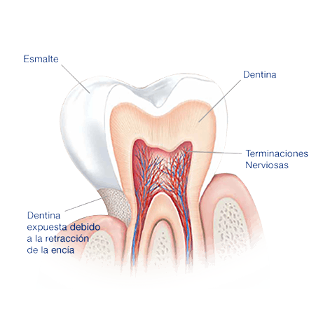 Aja Instruir Paisaje Qué Causa Sensibilidad Dental? | Sensodyne Colombia