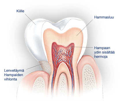Mikä aiheuttaa hampaiden vihlontaa?