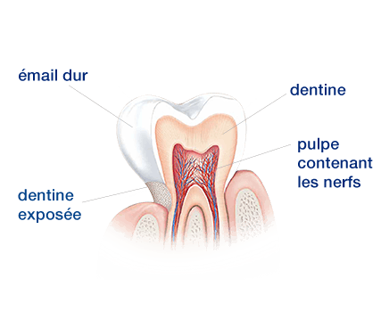 Quelles sont les causes de la sensibilité dentaire ?