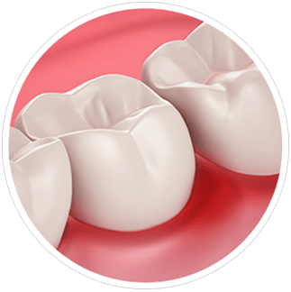 Santé des gencives et sensibilité dentaire