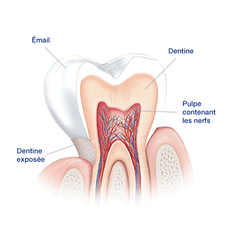 Quelles sont les causes de la sensibilité dentaire ? Quelles sont les causes de la sensibilité dentaire ?