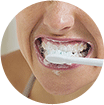 Traiter les dents sensibles