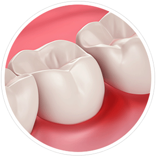 Santé des gencives et sensibilté dentaire