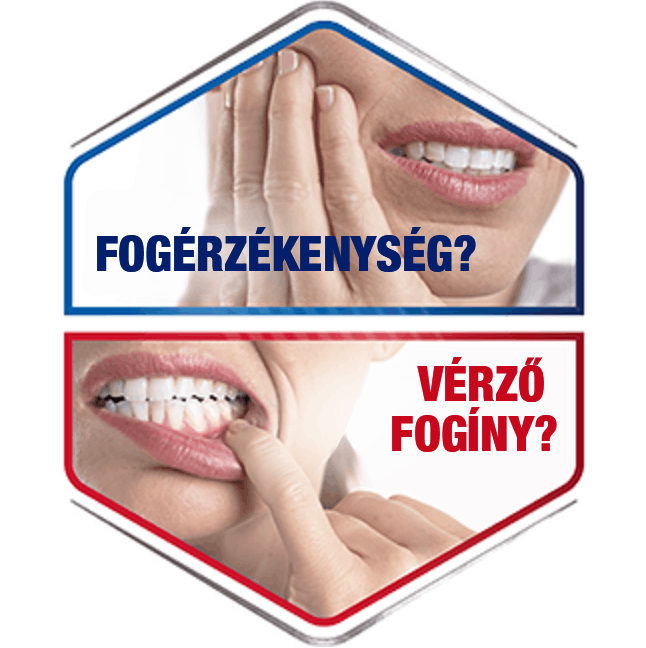 Fogérzékenység & vérző fogíny